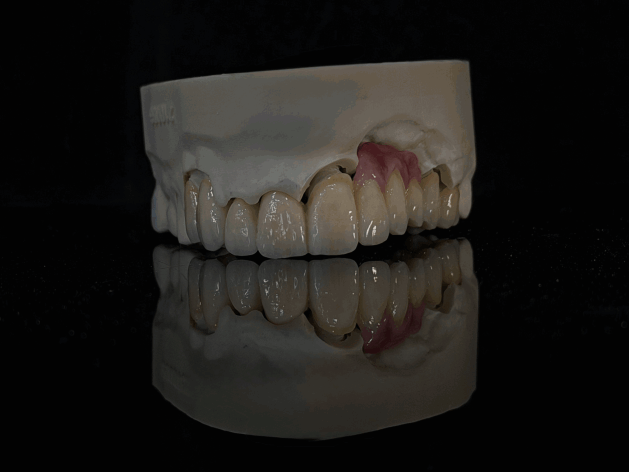 Protesi fissa su misura per studi dentistici