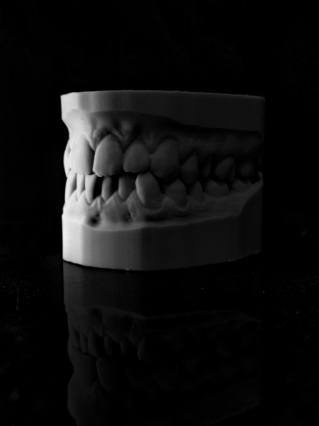 Modelli 3D odontotecnici ad alta precisione