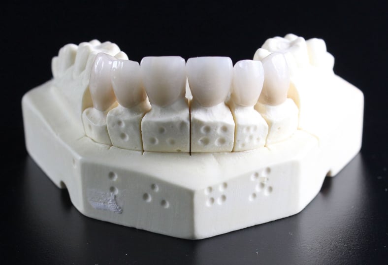 Lavorazioni odontotecniche digitali e protesiche