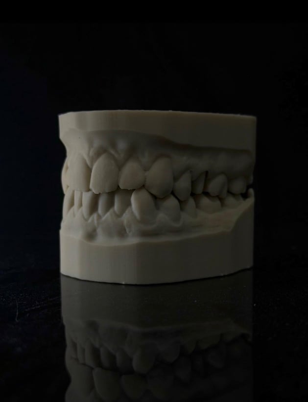 Stampa 3D odontotecnica ad alta definizione