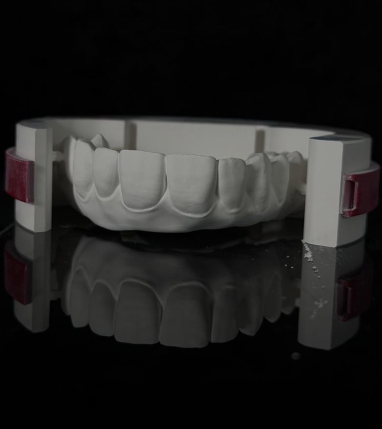 Lavorazioni in zirconia nel laboratorio odontotecnico